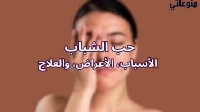 حب الشباب: الأسباب، والأعراض، والعلاج