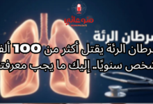 سرطان الرئة: الأعراض والأسباب وطرق الوقاية