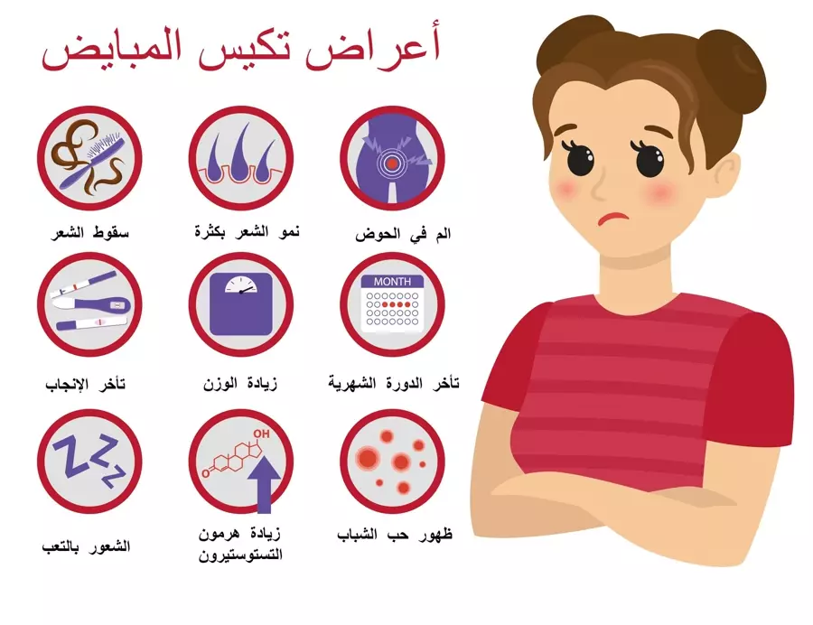 تكيس المبايض: الاسباب والاعراض وخيارات العلاج